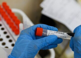 Число случаев коронавируса в Узбекистане выросло за сутки на 36