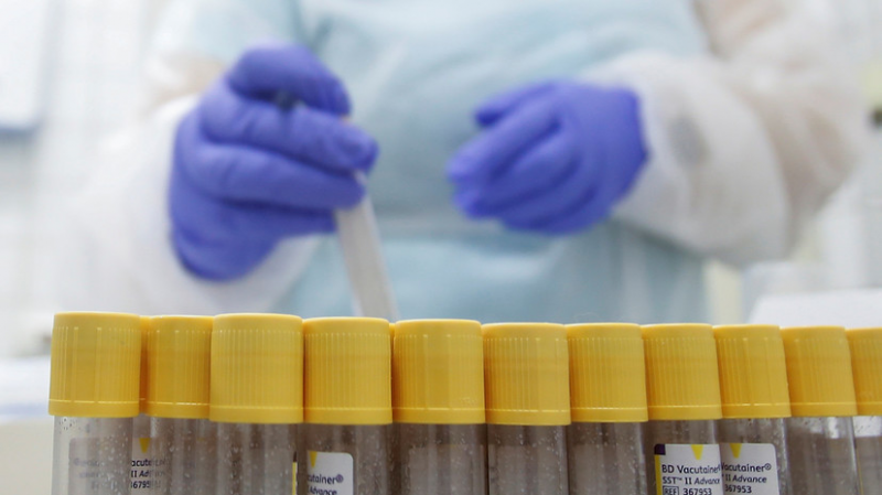 В Греции за сутки выявили 1526 новых случаев коронавируса