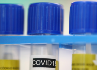 В Молдавии за сутки выявлено более 900 случаев коронавируса