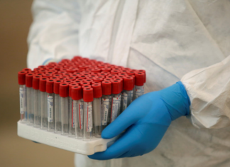 В Молдавии за сутки выявили 1788 новых случаев коронавируса