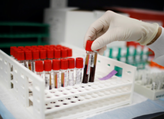 На востоке Австрии продлят режим локдауна