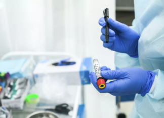 Приезжающим из Абхазии и Южной Осетии не нужно сдавать тест на COVID-19