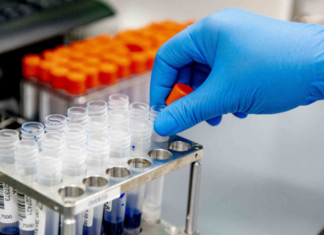 В Азербайджане число случаев коронавируса достигло 268 714