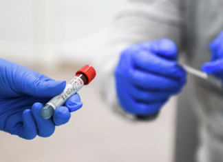 В Москве за сутки выявили 2252 случая коронавируса