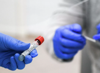 В Москве за сутки выявили более 2,5 тысячи случаев COVID-19