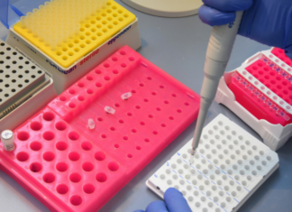 В Азербайджане число случаев коронавируса достигло 320 322