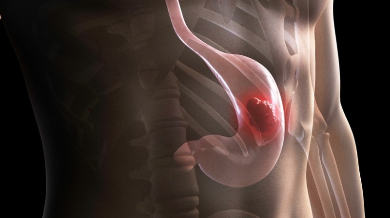 «Изменение пищевых привычек»: учёные — о неявных симптомах рака желудка и выявлении заболевания