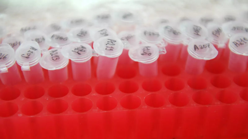 В Азербайджане число случаев коронавируса достигло 254 370